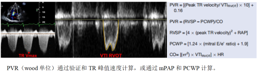 9effa6e1717d6508fd6a39ff8d1cd1c0.png