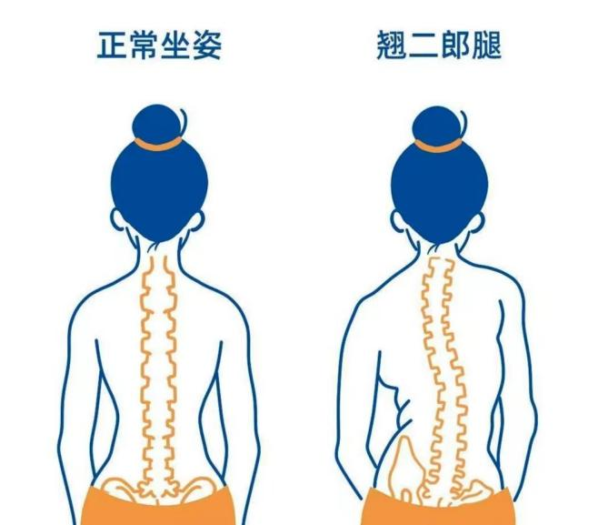 你必須知道的腰椎小知識
