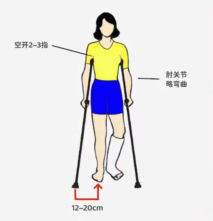 骨股頭壞死患者應該如何正確拄拐呢？