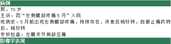 股骨頭缺血壞死影像診斷
