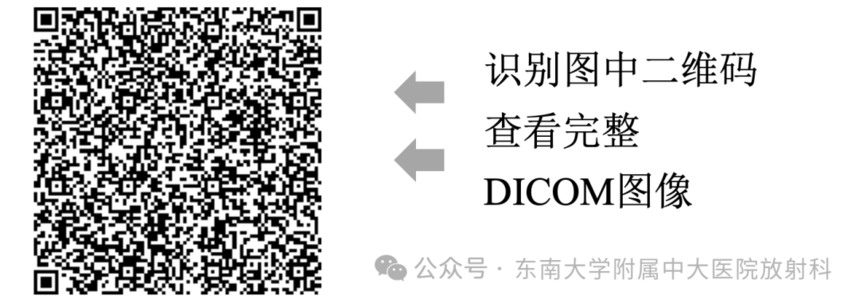 股骨頭缺血壞死影像診斷