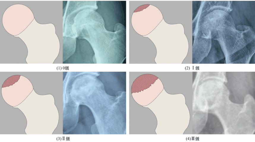 188体育官方主页app官方的中醫辨證標準