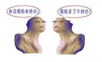 188体育官方主页app官方恢複的快、慢與(yu) 哪些因素有關(guan) 