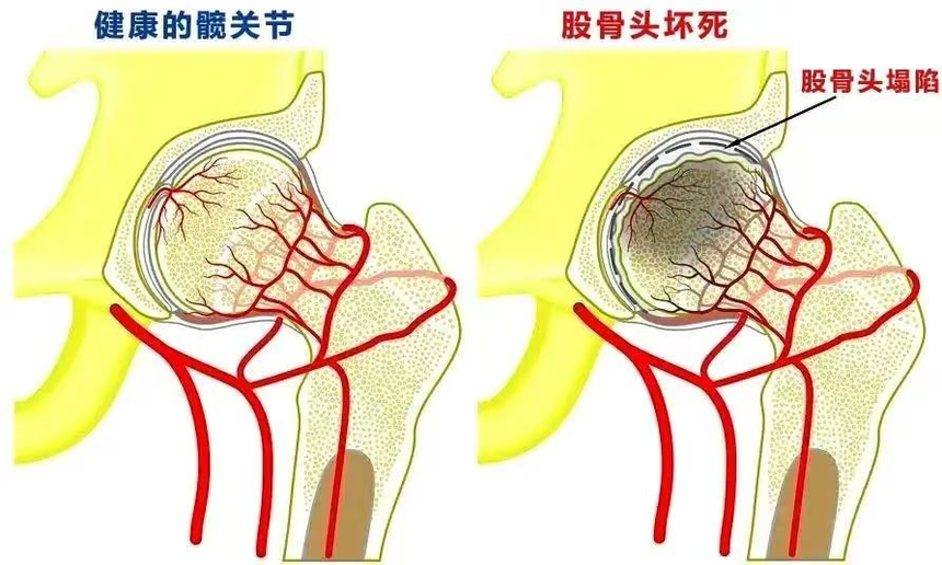 188体育官方主页app官方不可怕，記住這三個(ge) “早”