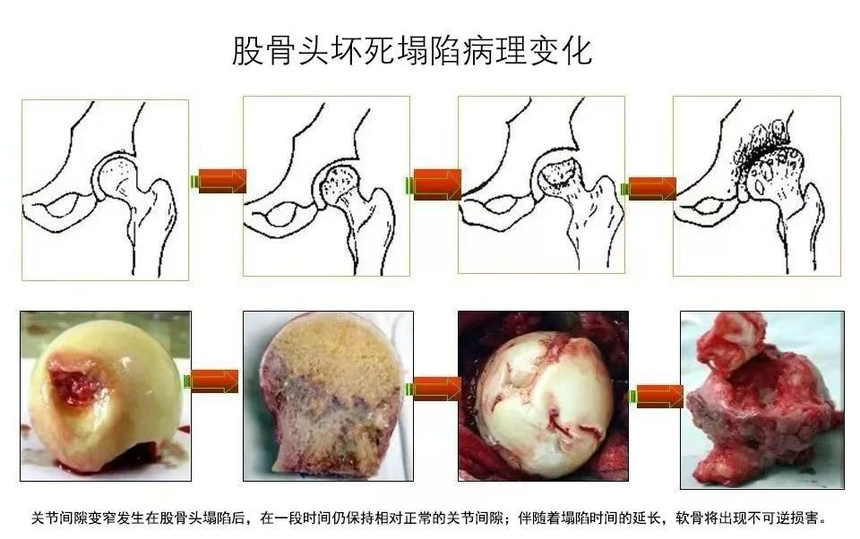 188体育官方主页app官方如何影響髖關(guan) 節的功能