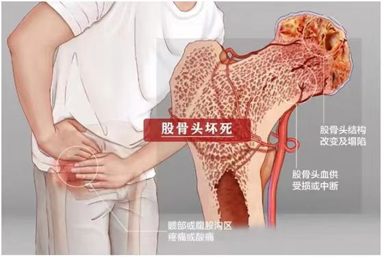 188体育官方主页app官方的成因到底是什麽(me) 