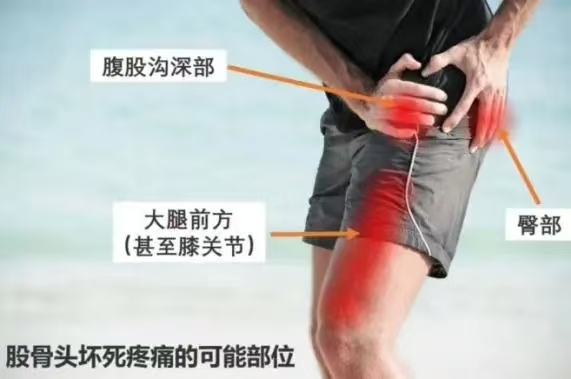 188体育官方主页app官方疼痛的五大特點