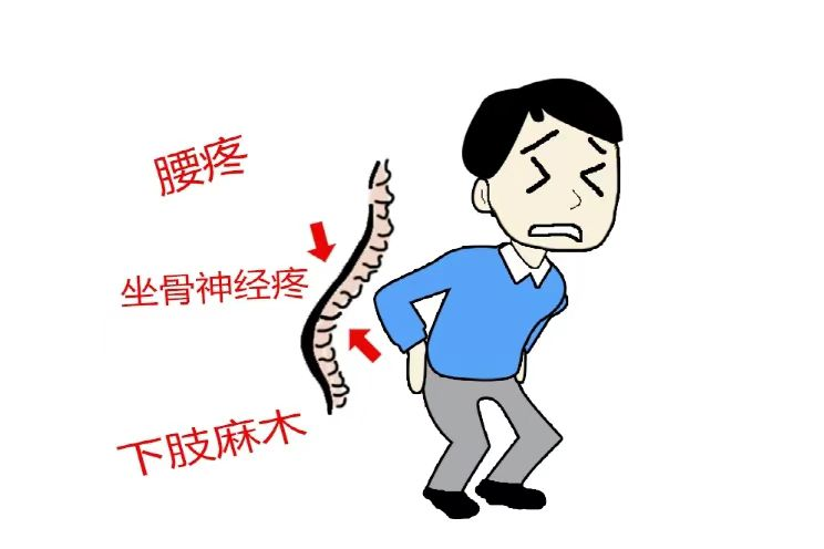 腰椎間盤突出的危害有哪些？