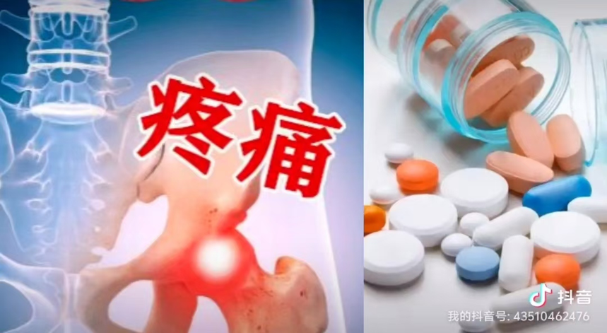 188体育官方主页app官方疼痛怎樣合理吃止痛藥？