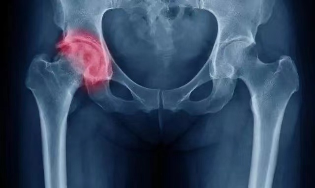 188体育官方主页app官方不想手術，需要注意什麽(me) ？