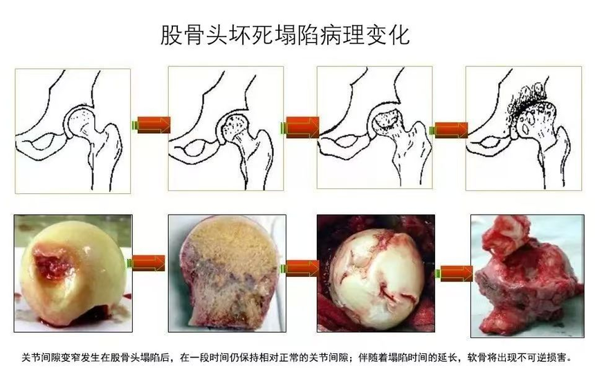188体育官方主页app官方一定會(hui) 塌陷嗎？