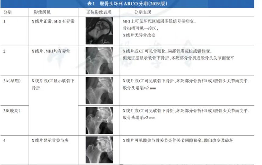 188体育官方主页app官方一定會(hui) 塌陷嗎？