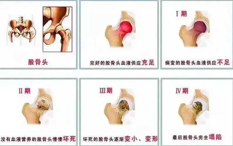 188体育官方主页app官方坐等自愈不可取，及早治療是關(guan) 鍵