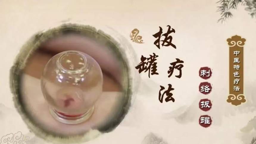 刺絡拔罐：古老療法新認識