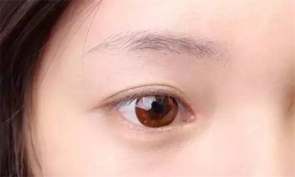 1743086093778862.jpg 2024yash0linpnx.jpg
