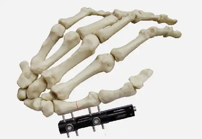 ݺҽơָƹ