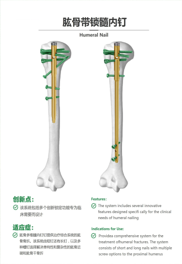 肱骨帶鎖髓內(nèi)釘