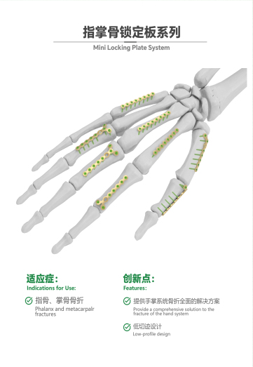 指掌骨鎖定板系列