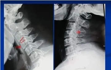 1726047660568300.png image.png