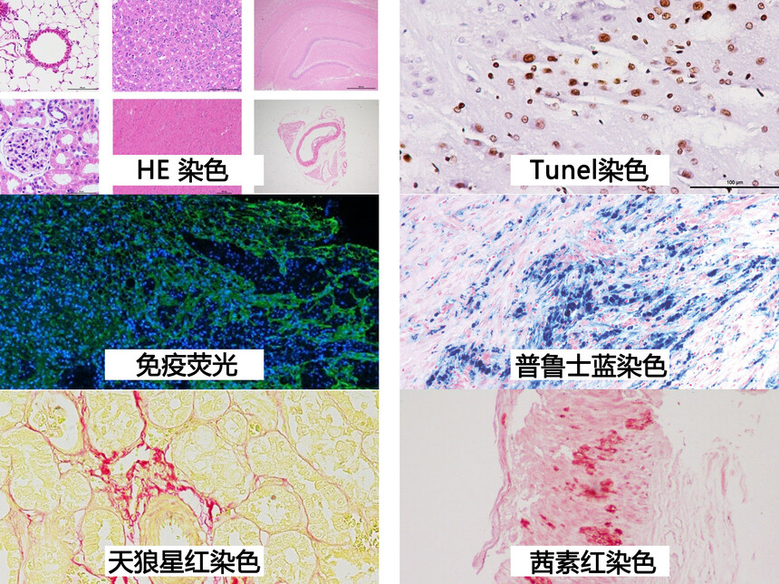 1788500201181600.jpg 病理图片拼贴.jpg
