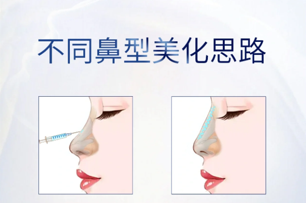 ��ͬ�������ѡ���ʺ��Լ��ı��ͣ�