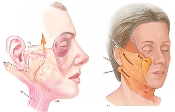 ��Ƥ����