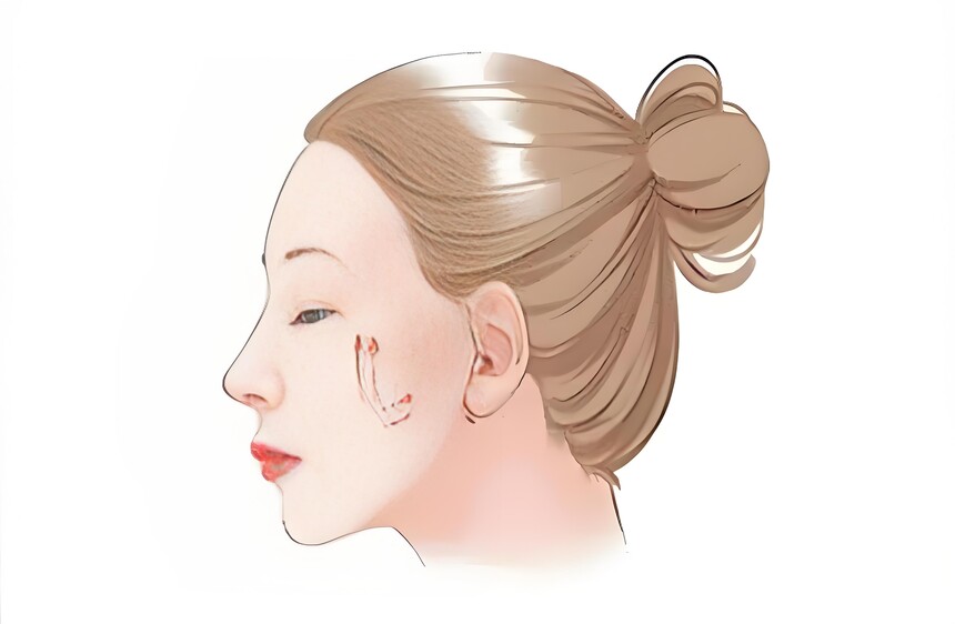 ����ƤvsС��Ƥ�����ѡ��