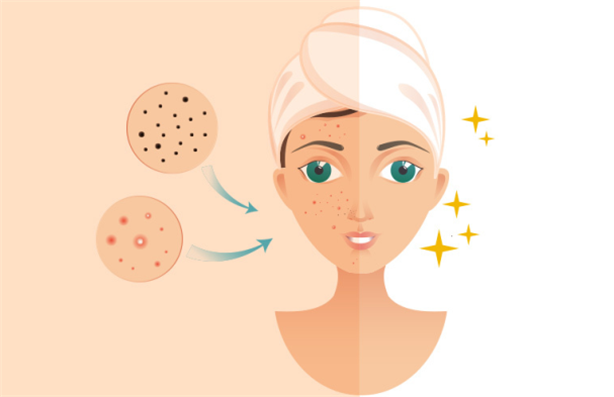 ���ϳ�������ʲôԭ��