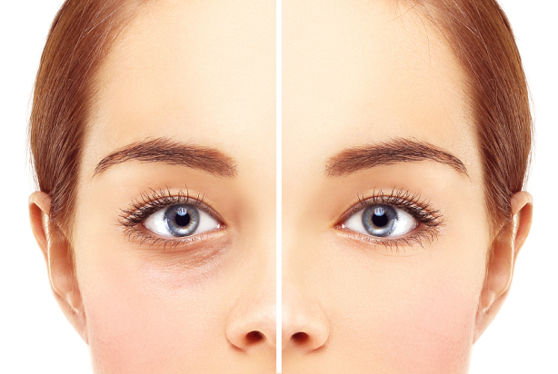 ��Ƥ���Գ�