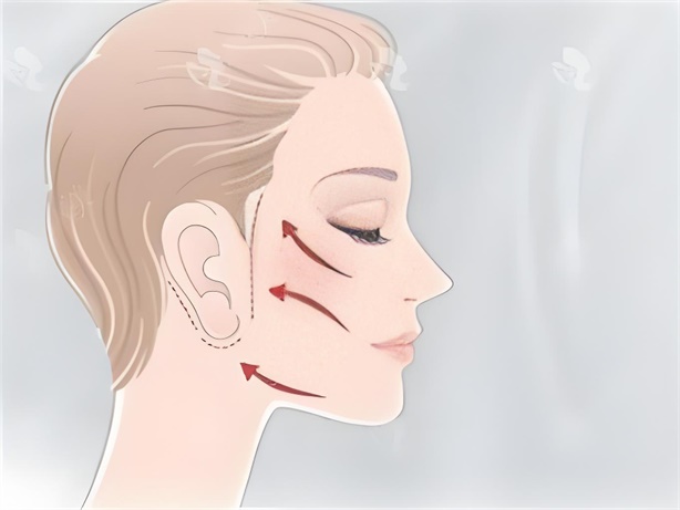 ��Ƥ������û�и����ã�