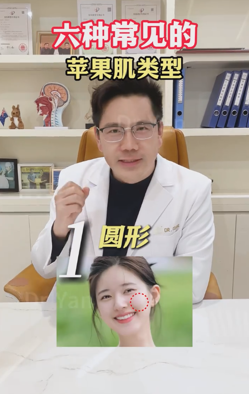 闫海廷苹果肌复位 闫海廷苹果肌复位