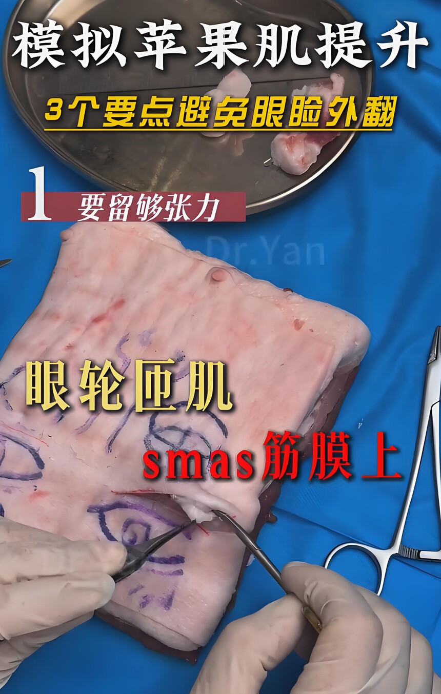 ƻ��������