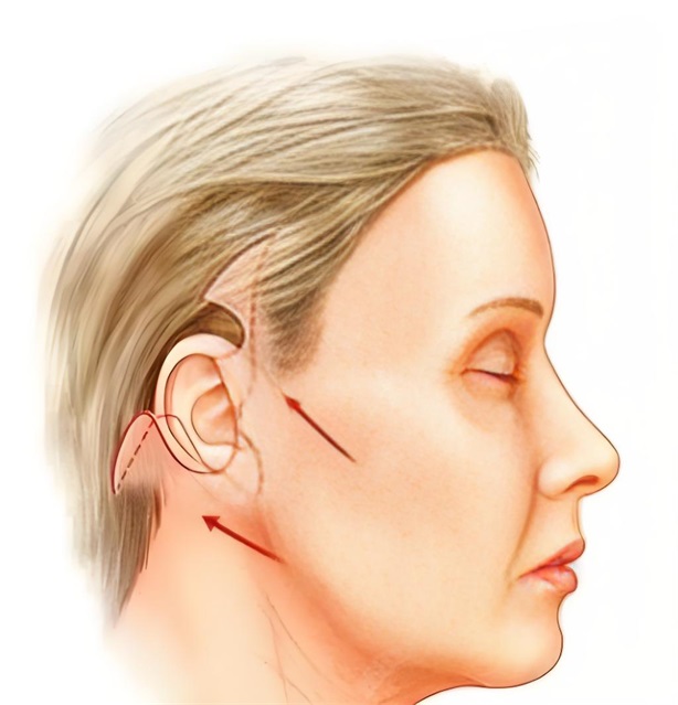 �沿��Ƥ�п�