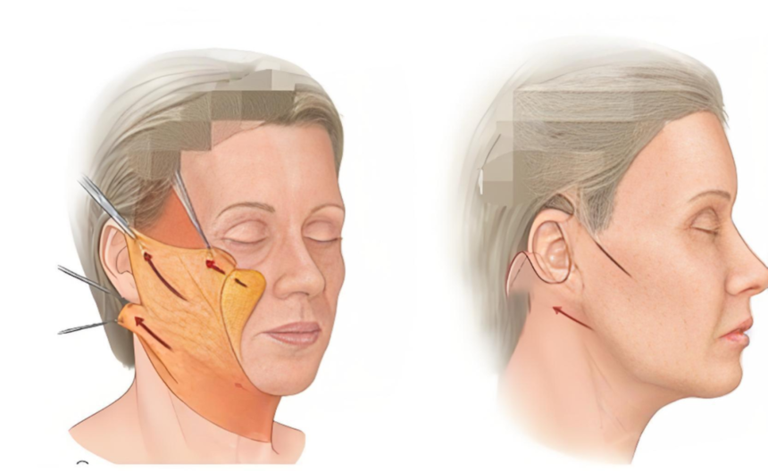 ��Ƥ����