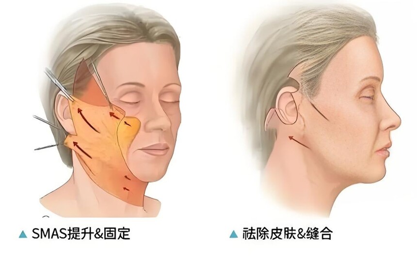 ��Ƥ��Ӧ��Ⱥ