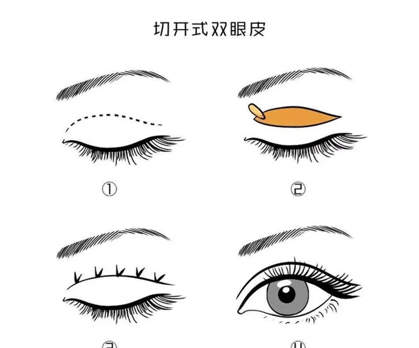 双眼皮排行榜 双眼皮排行榜