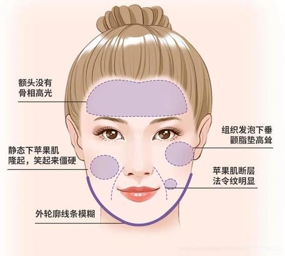 苹果肌馒化 苹果肌馒化