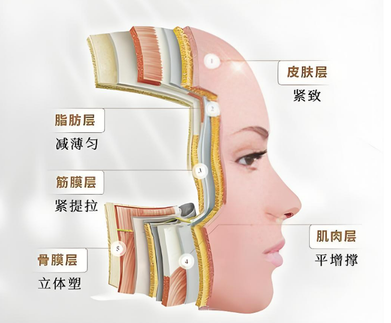 面部拉皮疤痕隐蔽.png 面部拉皮疤痕隐蔽.png