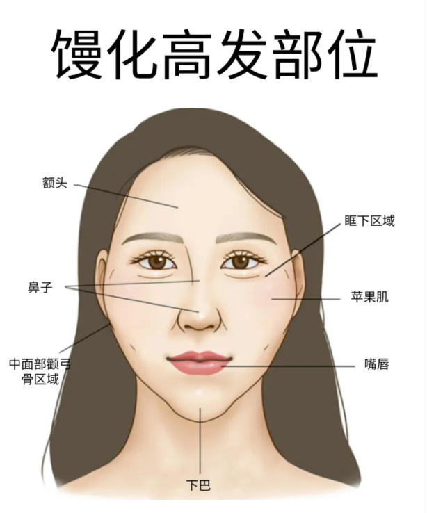 苹果肌馒化修复 苹果肌馒化修复