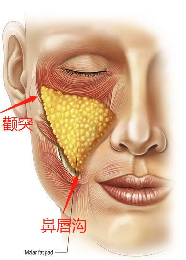 中面部提升 中面部提升