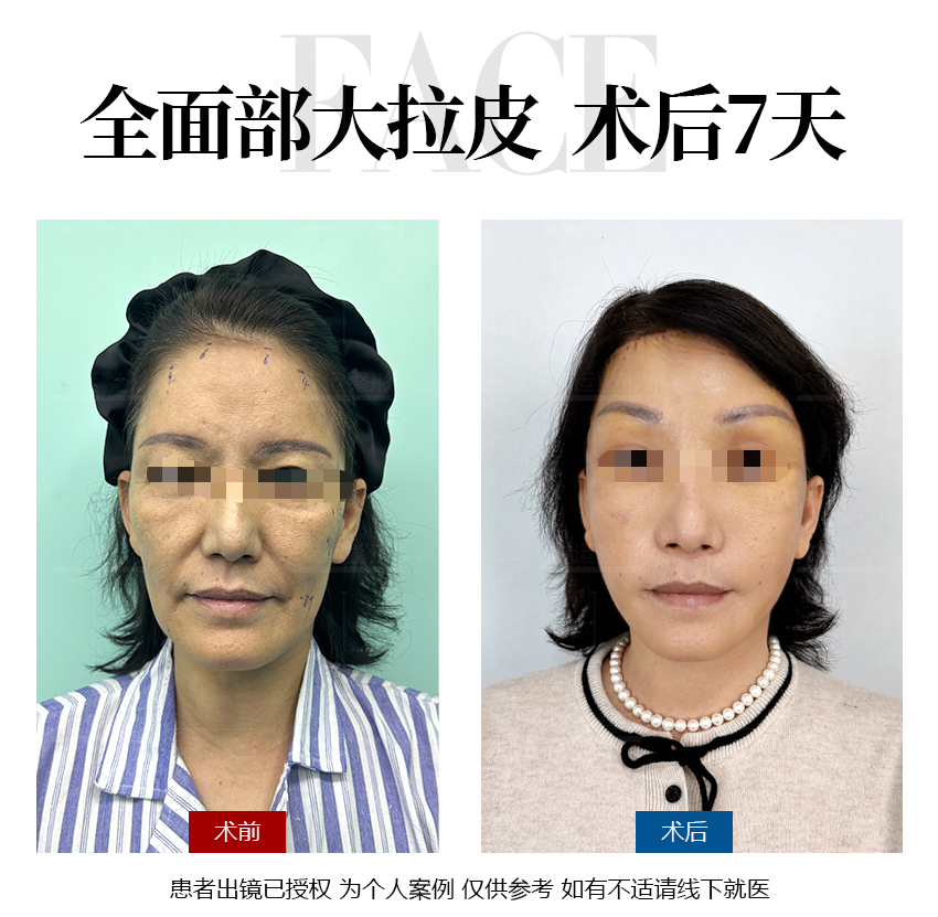 κ������Ƥ����.png