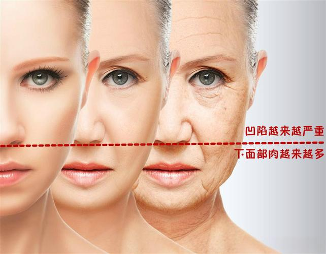 中面部抗衰医生 中面部抗衰医生