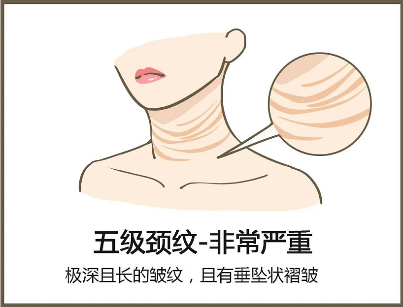 颈纹深.png 颈纹深.png