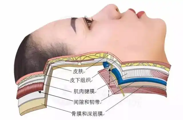 苹果肌复位 苹果肌复位