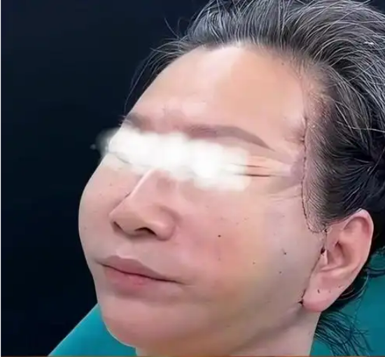 ��Ƥ�޸�.png