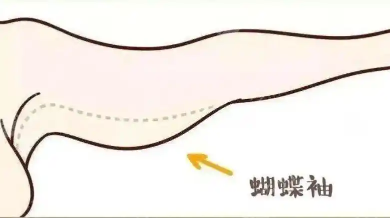 四肢拉皮 四肢拉皮