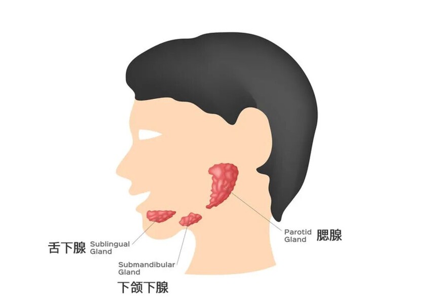颌下腺肥大.jpg 颌下腺肥大.jpg