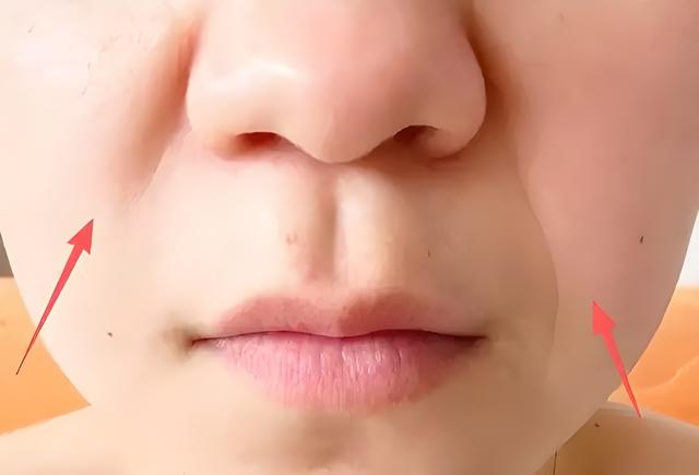 法令纹 法令纹