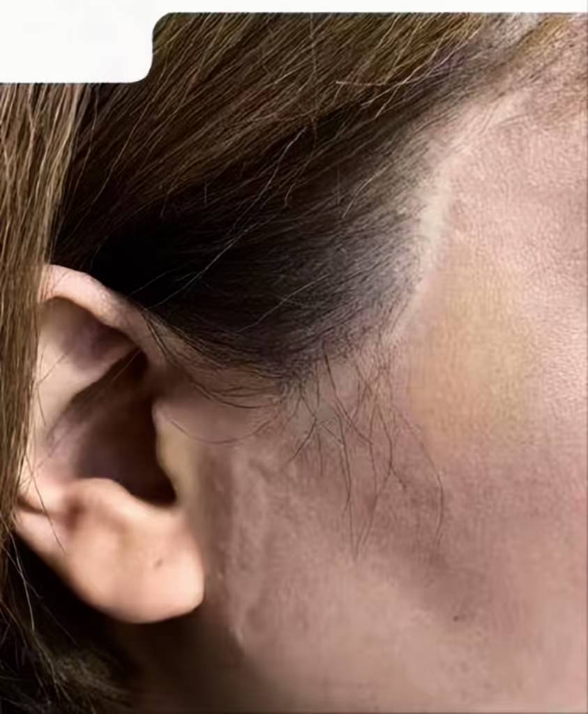 魏广运拉皮修复.jpeg 魏广运拉皮修复.jpeg