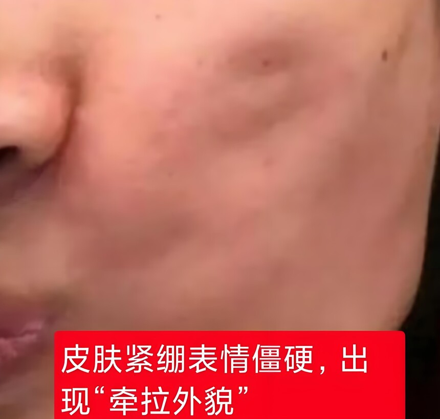 ���Ѷ���Ƥ�޸�.jpeg